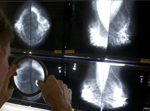 Health screening task force to re-launch next spring after report calls for reform